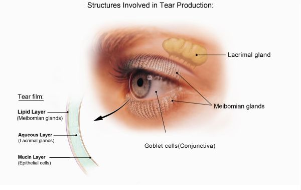 Meibomian gland dysfunction